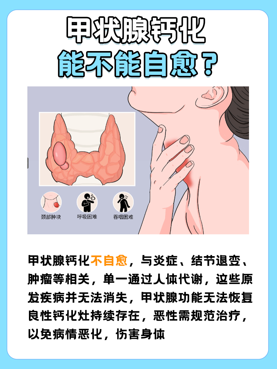 甲状腺钙化会自愈吗？看一下就知道