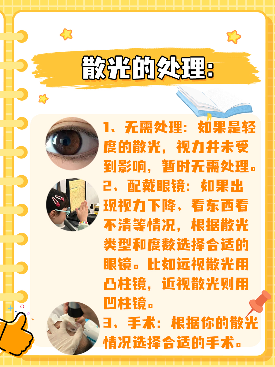 出现散光怎么办？教你这几招！