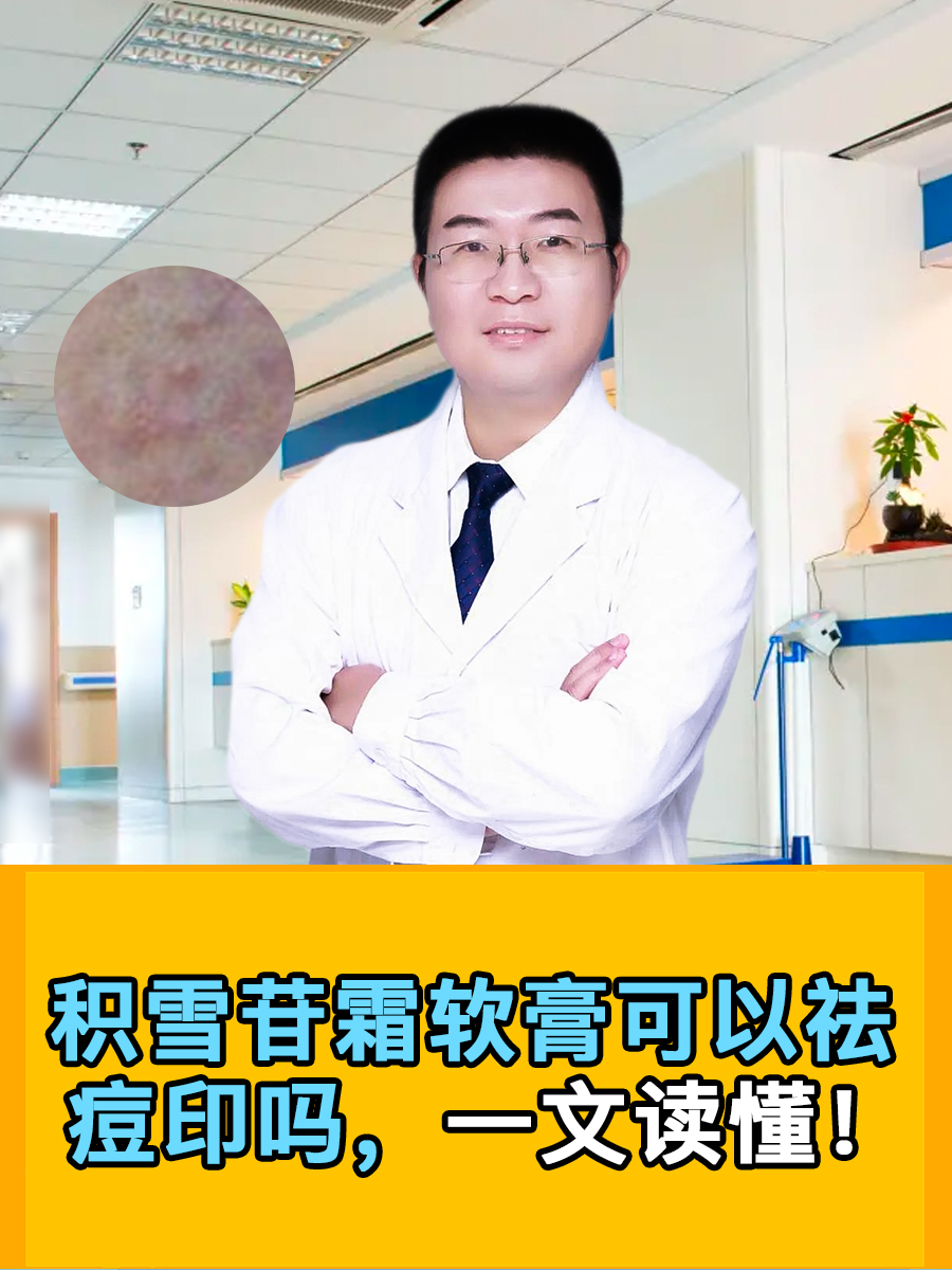 积雪苷霜软膏可以祛痘印吗，一文读懂！