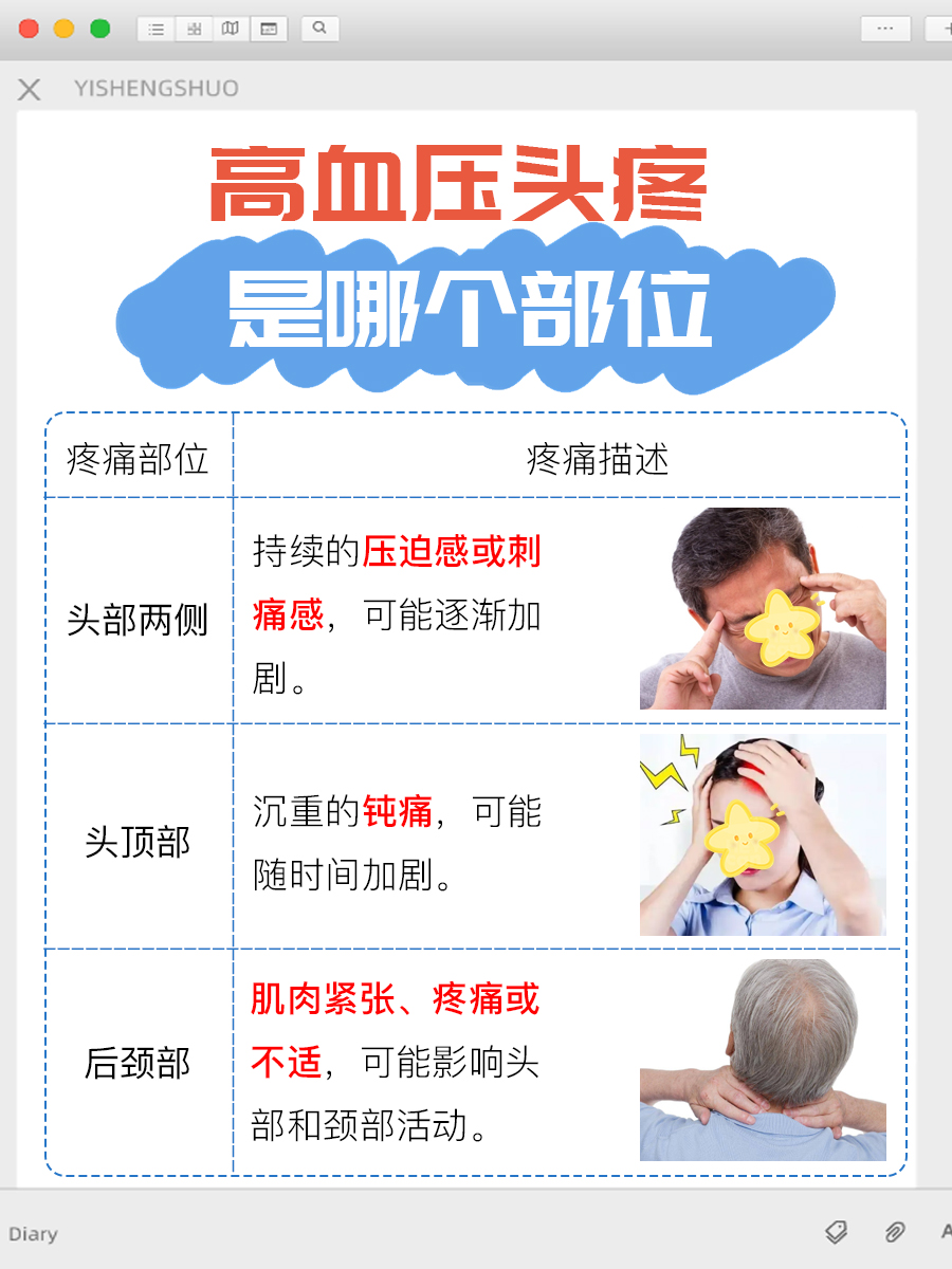 高血压引发的头痛：常见发作部位解析。
