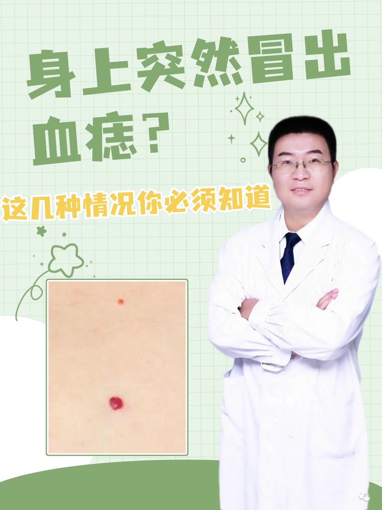 身上突然冒出血痣？这几种情况你必须知道