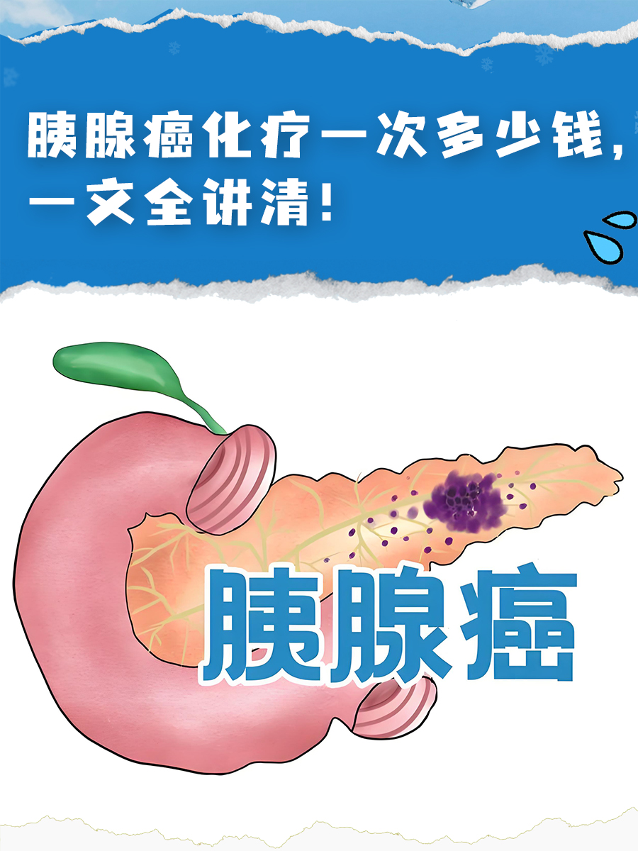 胰腺癌化疗一次多少钱，一文全讲清！