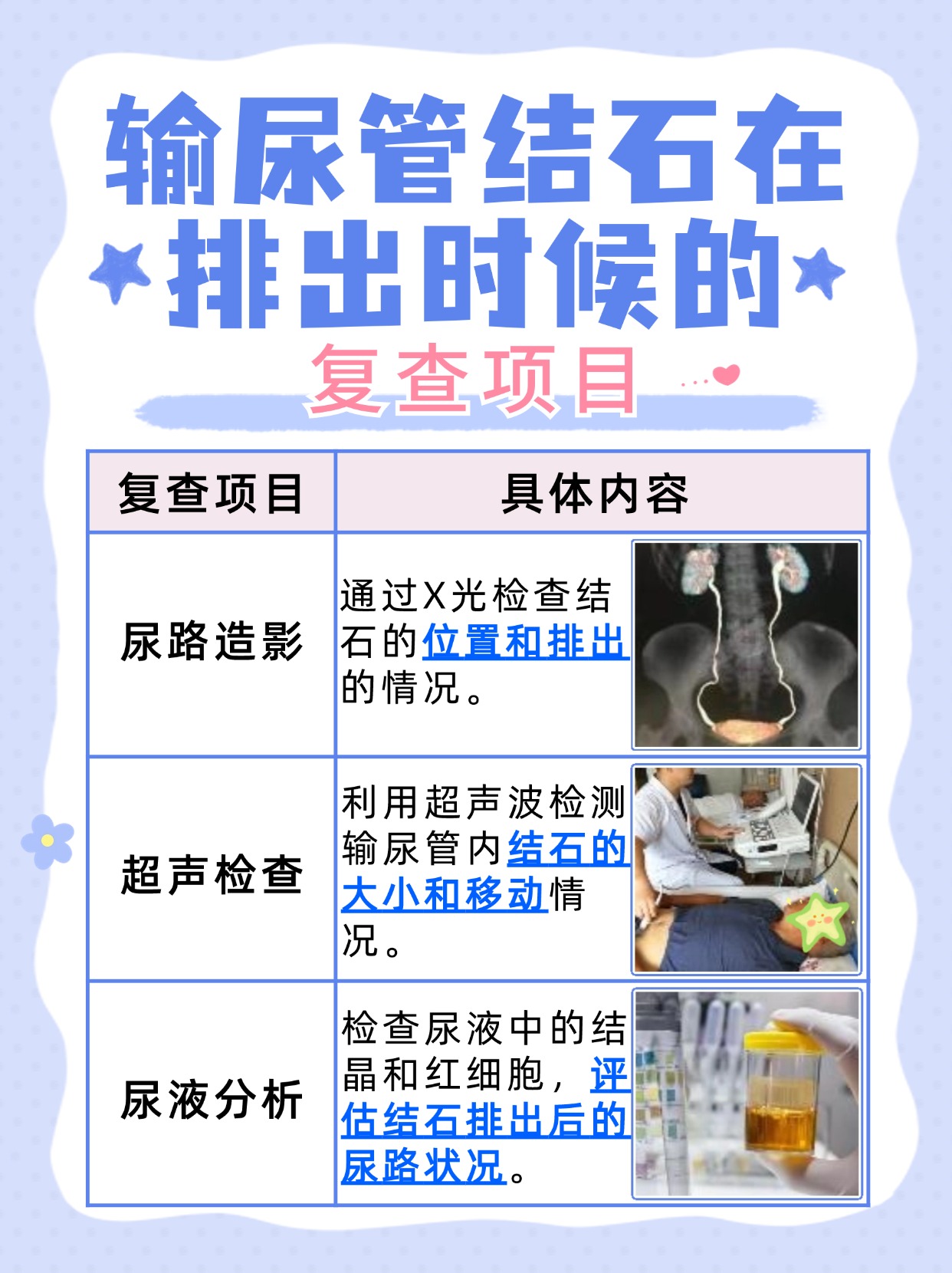 输尿管8mm结石,可以这样排出!