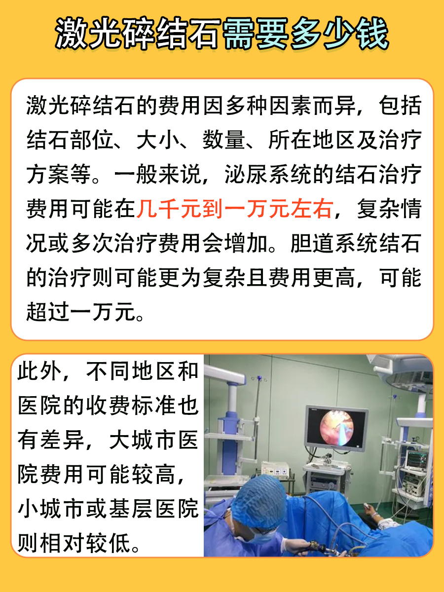 激光碎结石的费用,需要多少钱?