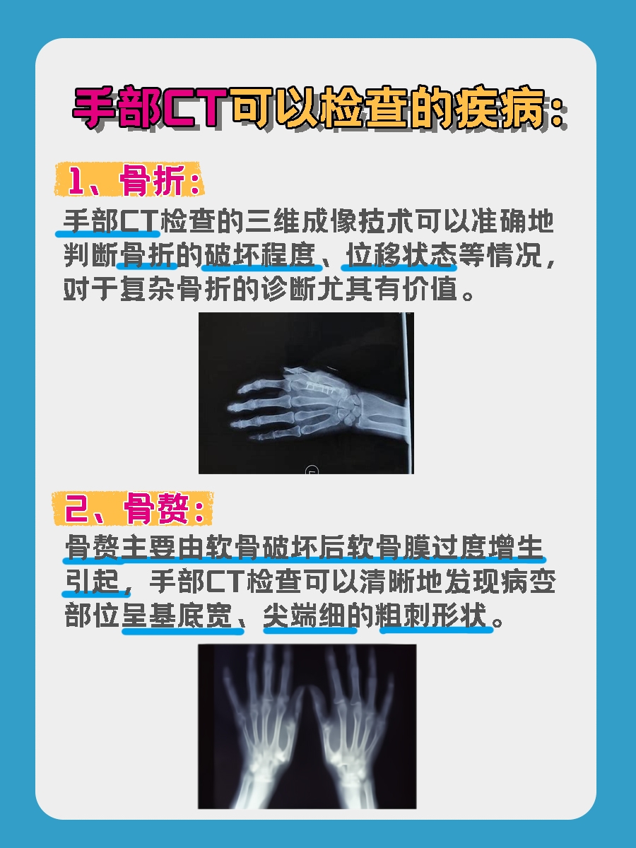 手部CT费用大揭秘，别再被“忽悠‘’了！