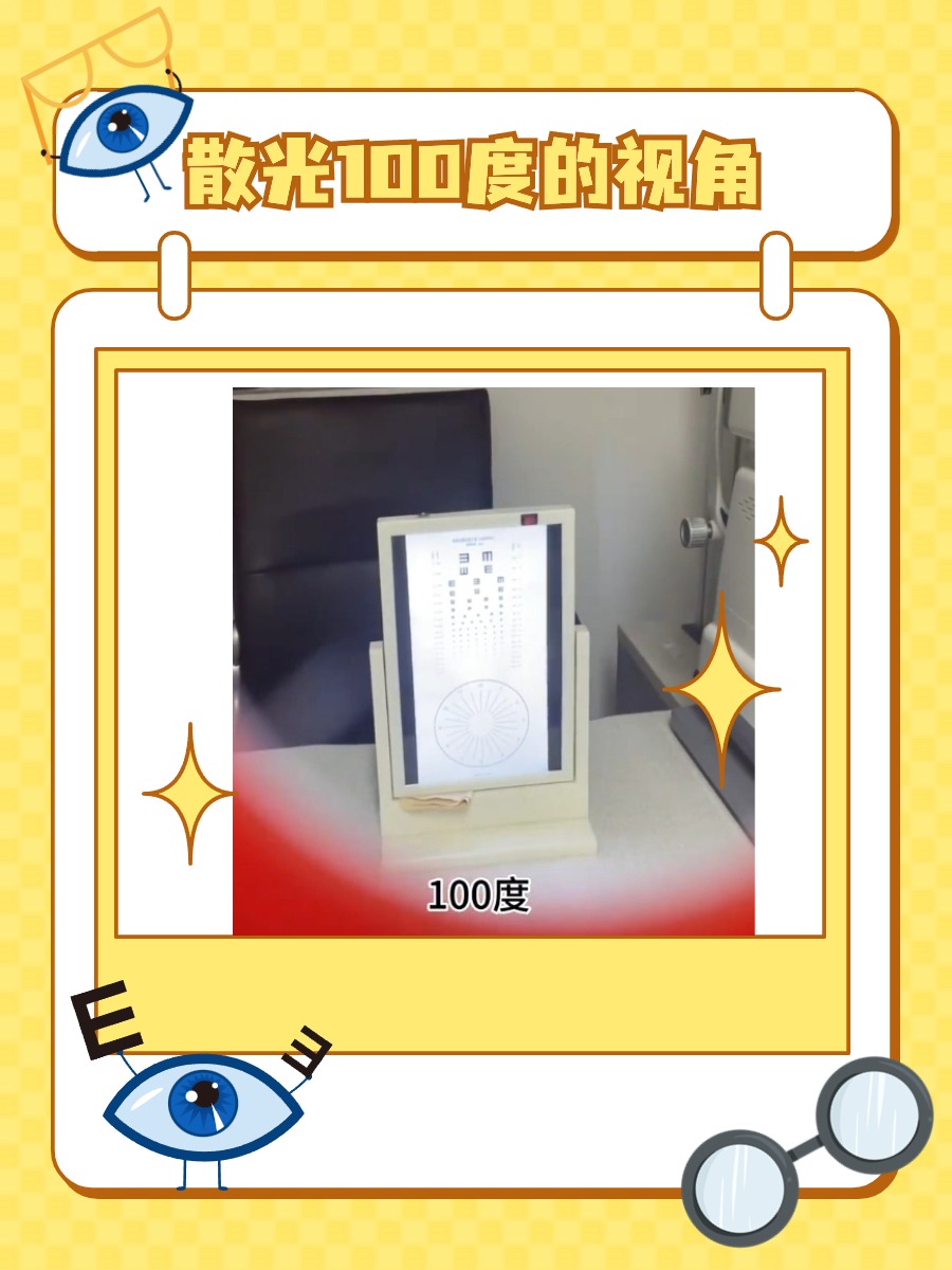 散光100度如何影响视觉？深度解析散光问题