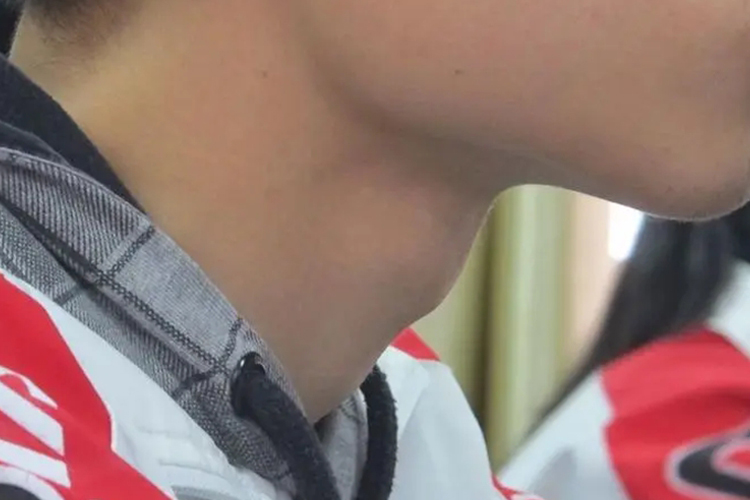 男性青少年正常的喉结图