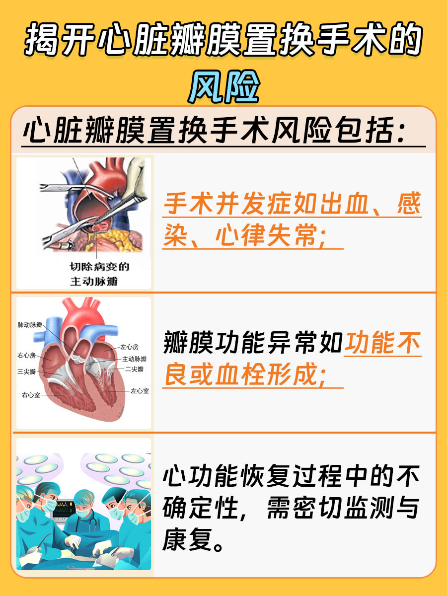 心脏瓣膜置换：手术风险全解析