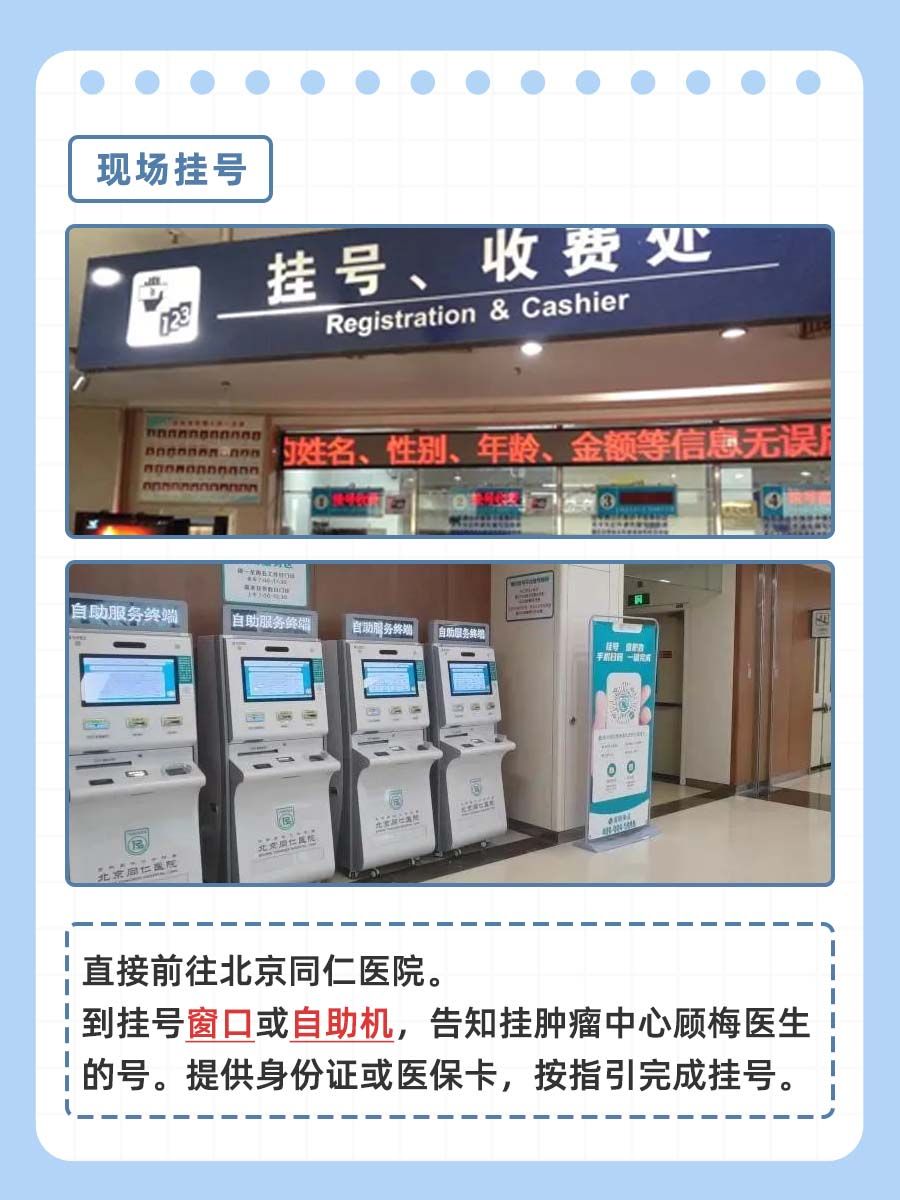 北京同仁医院顾梅医生怎么样？怎么挂号？