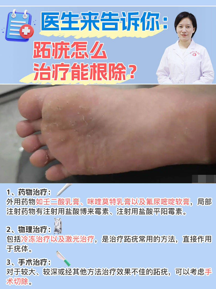 医生来告诉你：跖疣怎么治疗能根除？