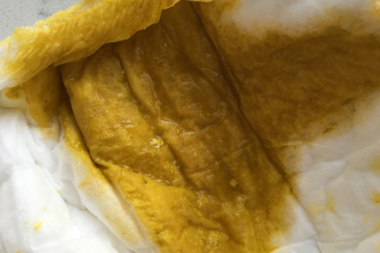 2月宝宝拉水样大便图 2月宝宝拉水样大便图