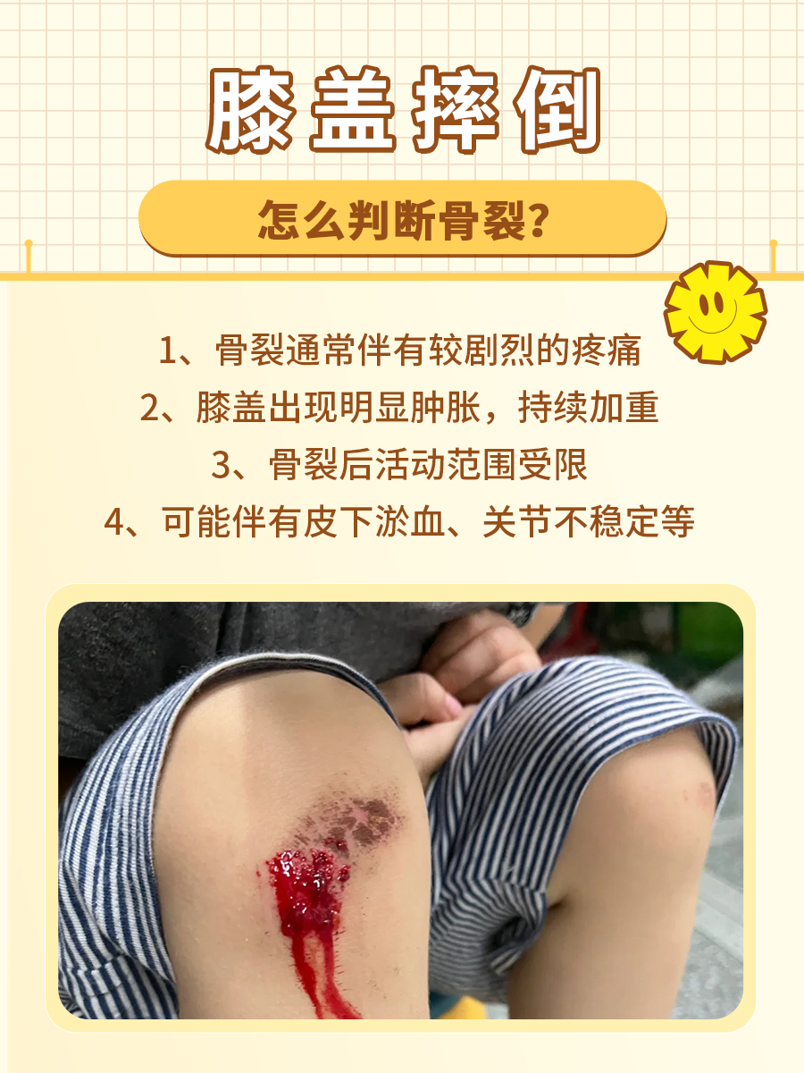 膝盖摔倒不要慌，一文教你如何判断骨裂！