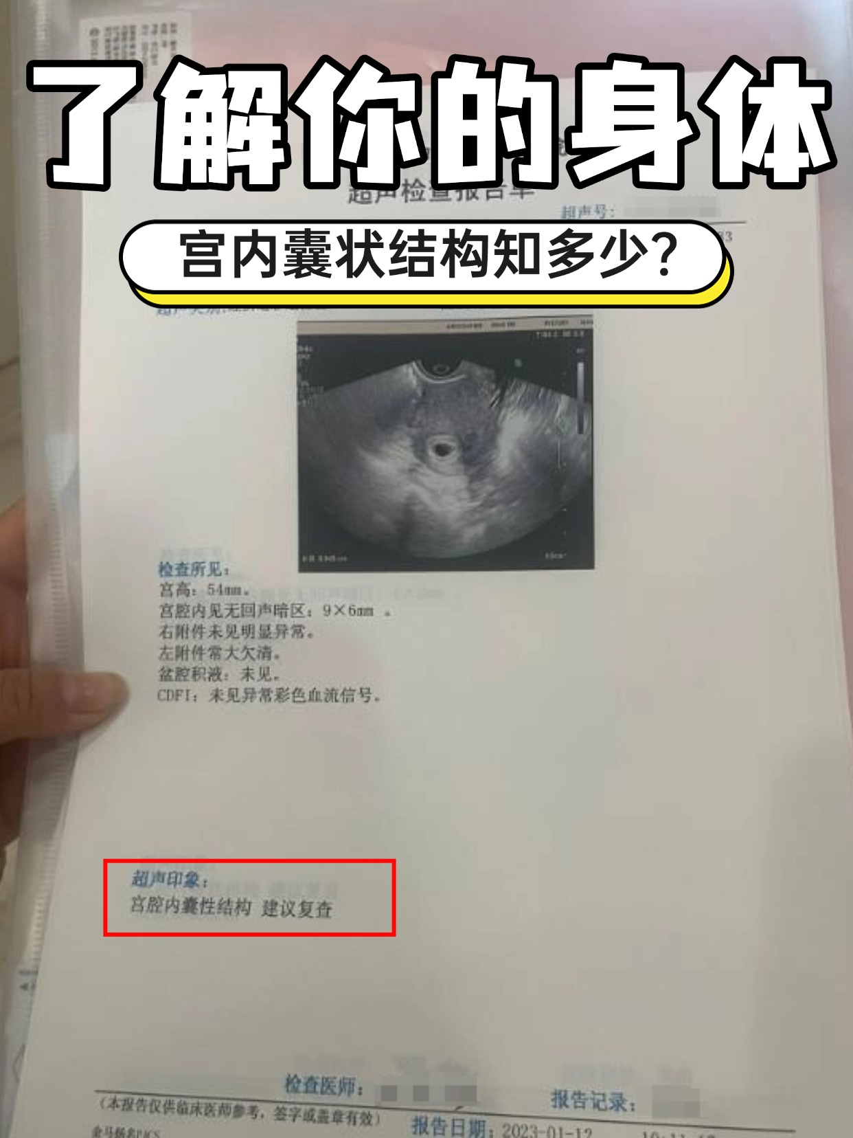 了解你的身体：宫内囊状结构知多少？