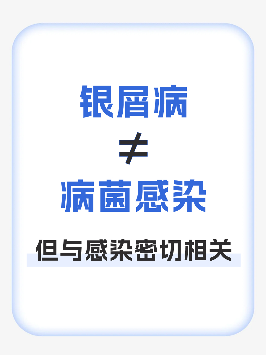 银屑病是什么病菌？医生带你科学认识
