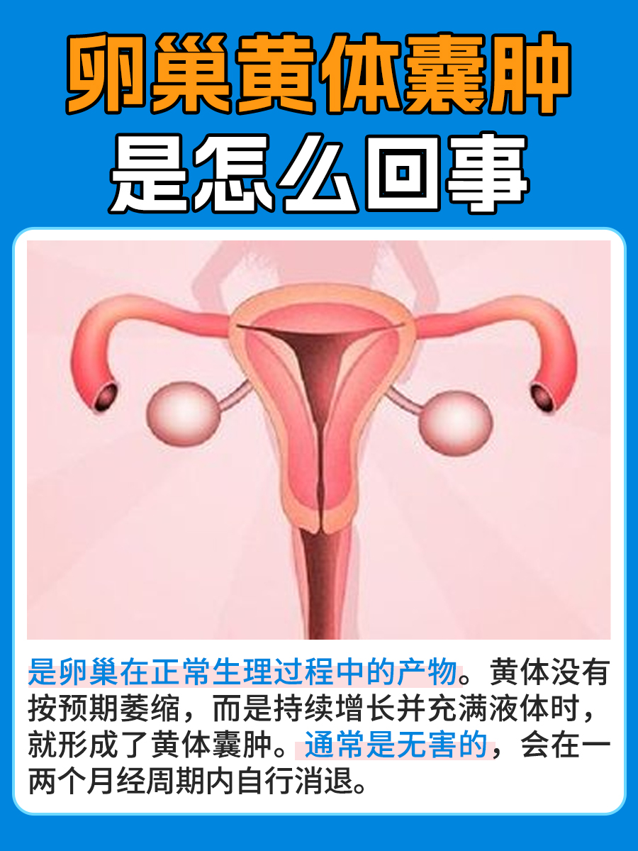 一文解析：卵巢黄体囊肿是怎么回事