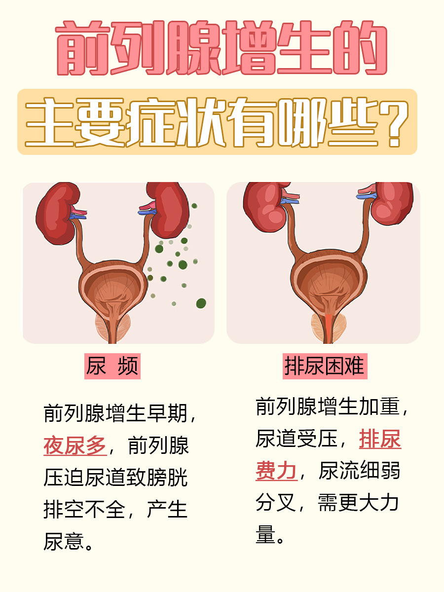 带你了解:前列腺增生吃什么药