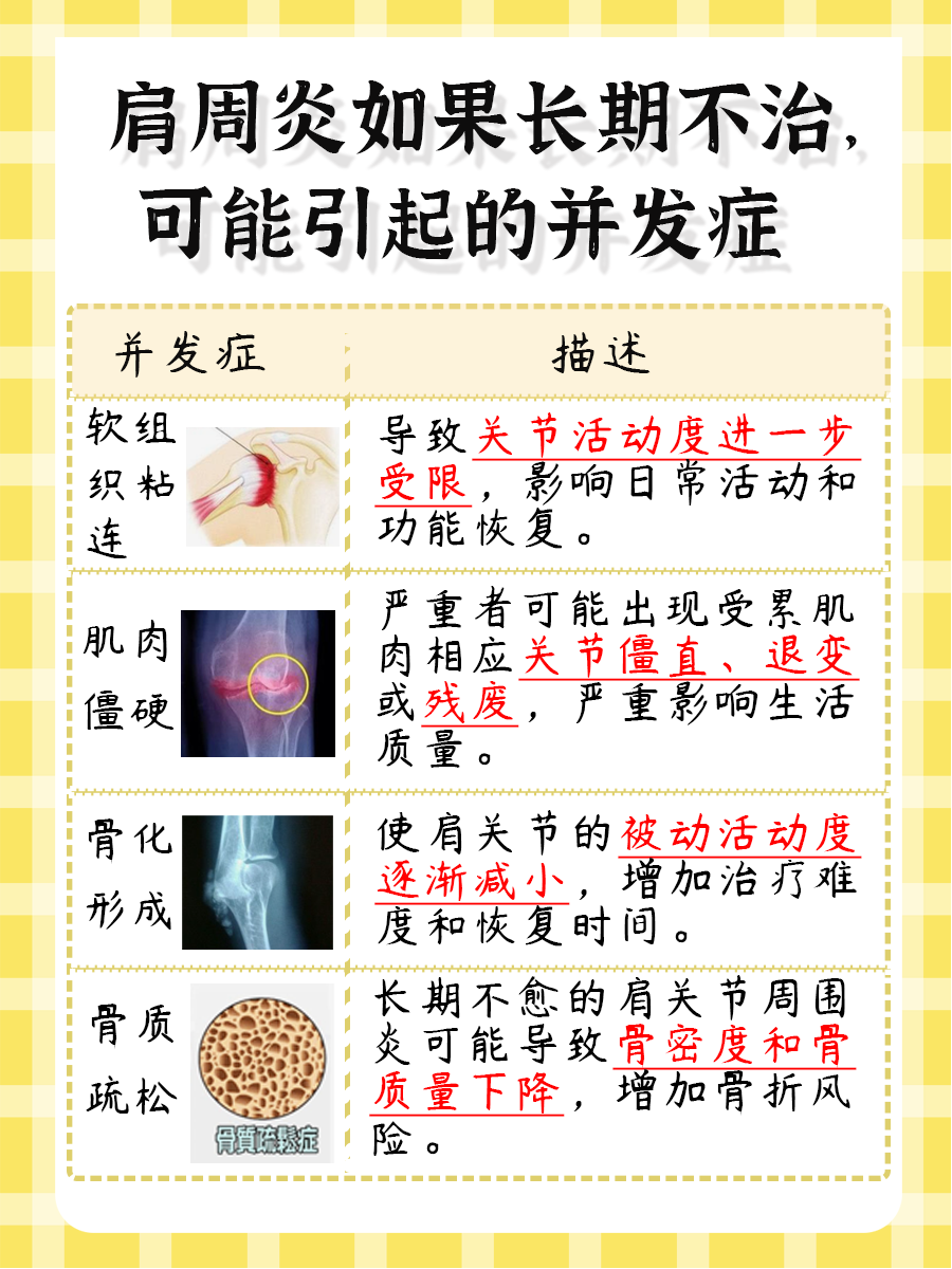 医生告诉你，肩周炎的治疗方法