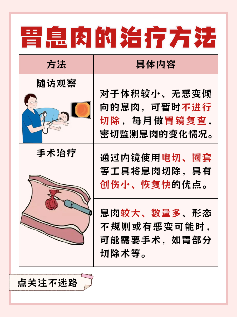 探究：胃息肉是否一定要切除？