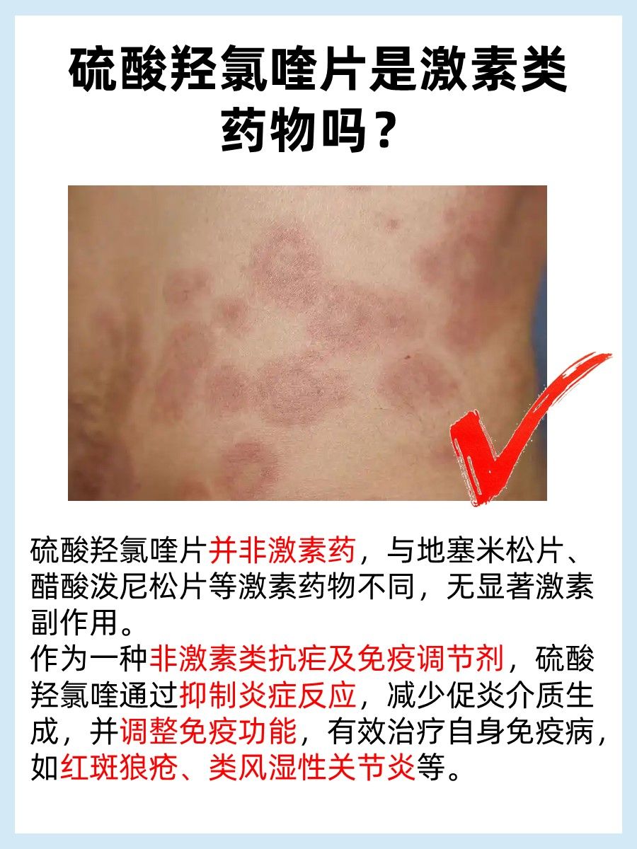 激素?非激素?硫酸羟氯喹片的真相