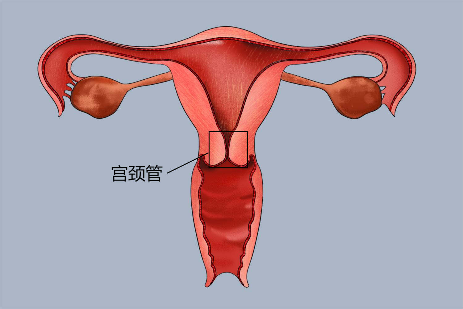 宫颈管呈漏斗状图