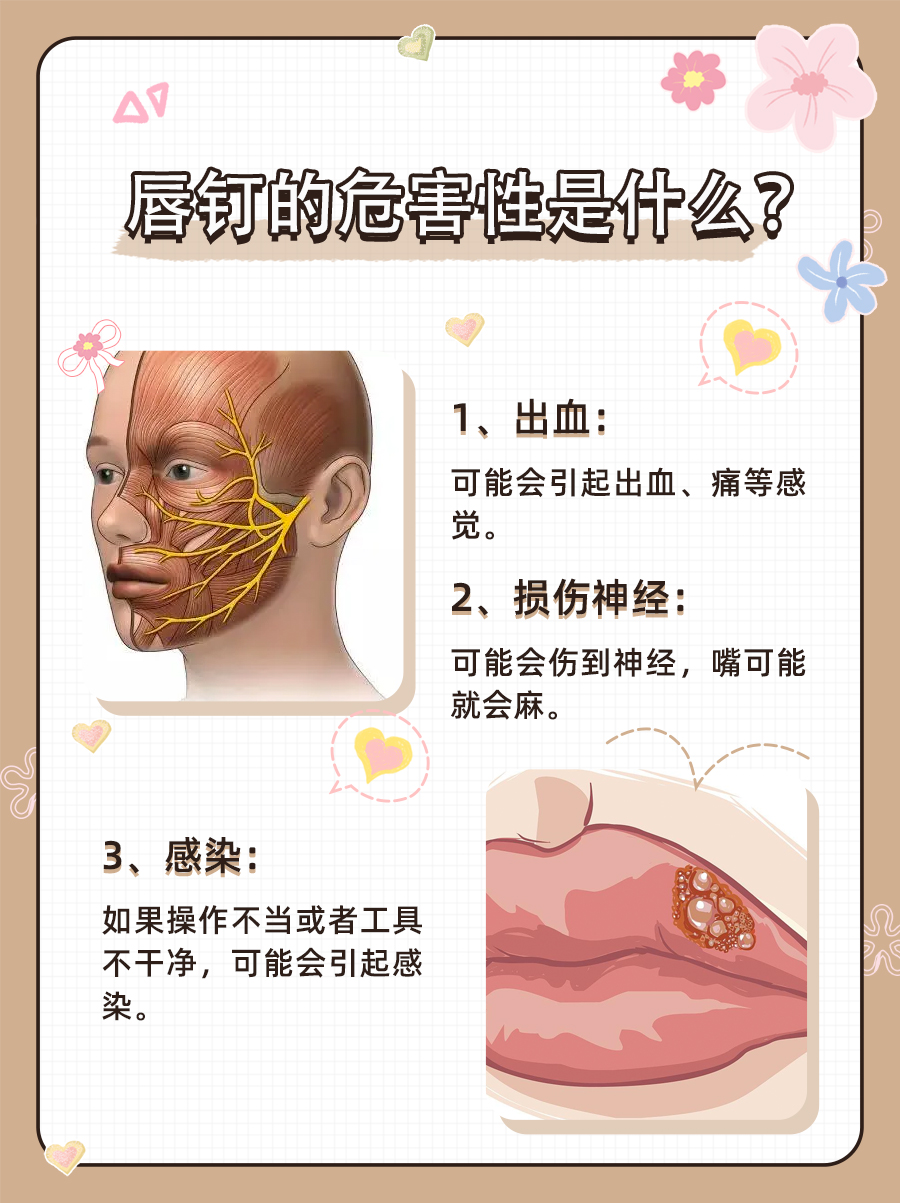 唇钉的危害性是啥？来听听医生怎么说