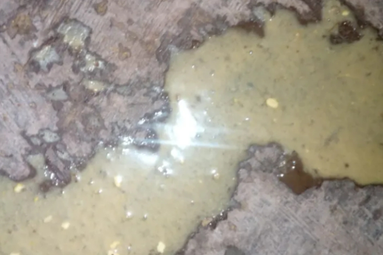 米泔水样大便图