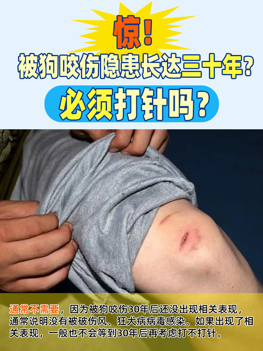 惊！被狗咬伤隐患长达三十年？必须打针吗？