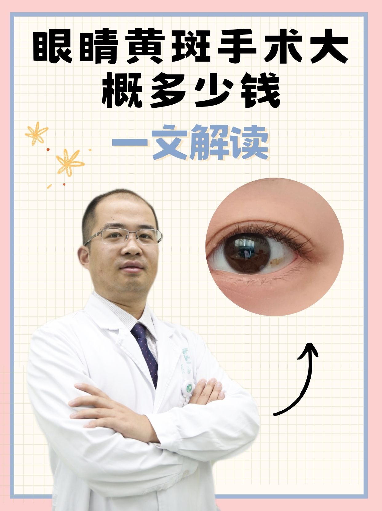 眼睛黄斑手术大概多少钱，一文解读