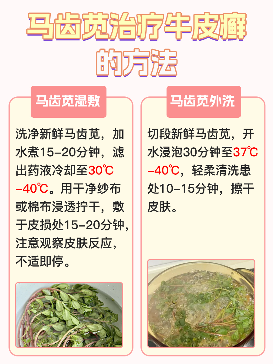 好奇不?马齿苋治牛皮癣有这些法!