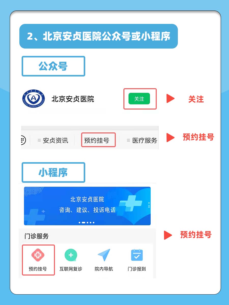 北京安贞医院孟康大夫怎么样?怎么挂号?