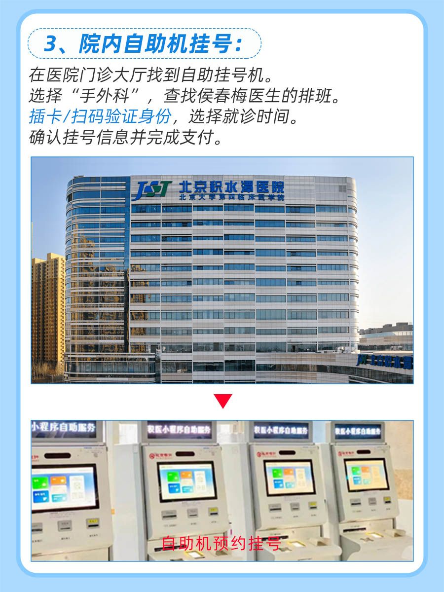 北京积水潭医院侯春梅医生怎么样？怎么挂号？