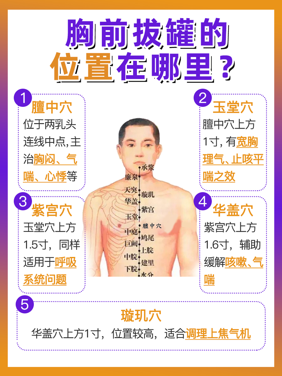 胸前拔罐12个位置示意图