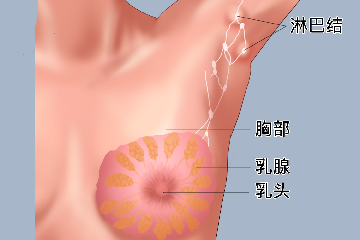 女性乳腺淋巴结肿大图 女性乳腺淋巴结肿大图