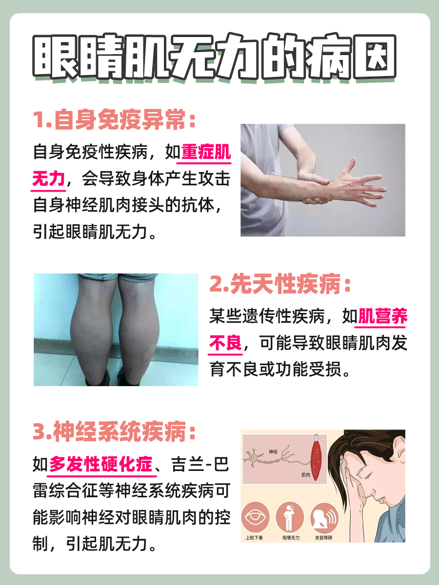 眼睛肌无力的图片