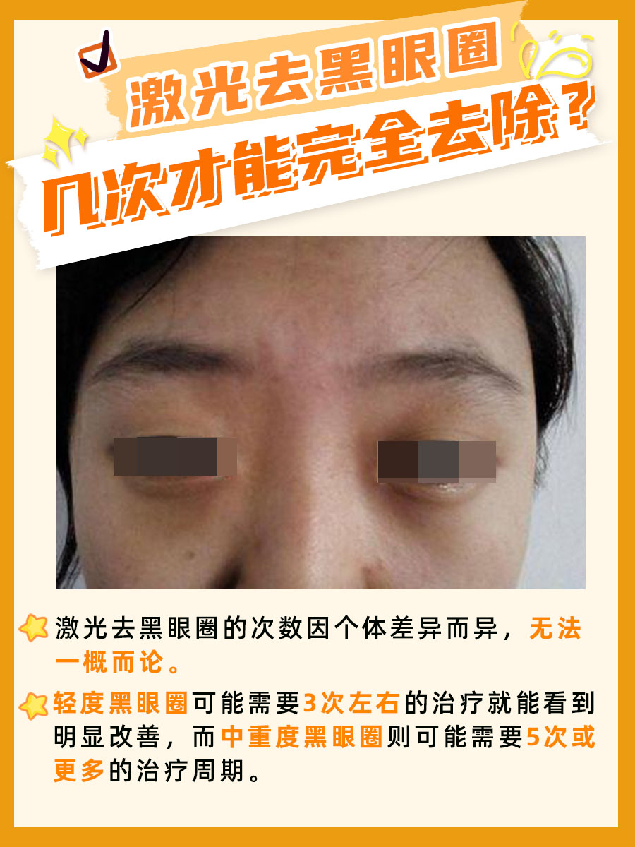 专业解读：激光去黑眼圈要几次才能完全去除？