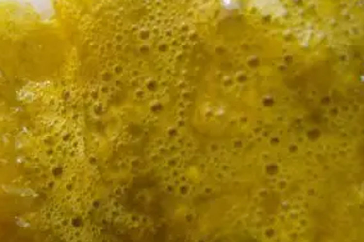 蛋花汤样大便图片 蛋花汤样大便图片