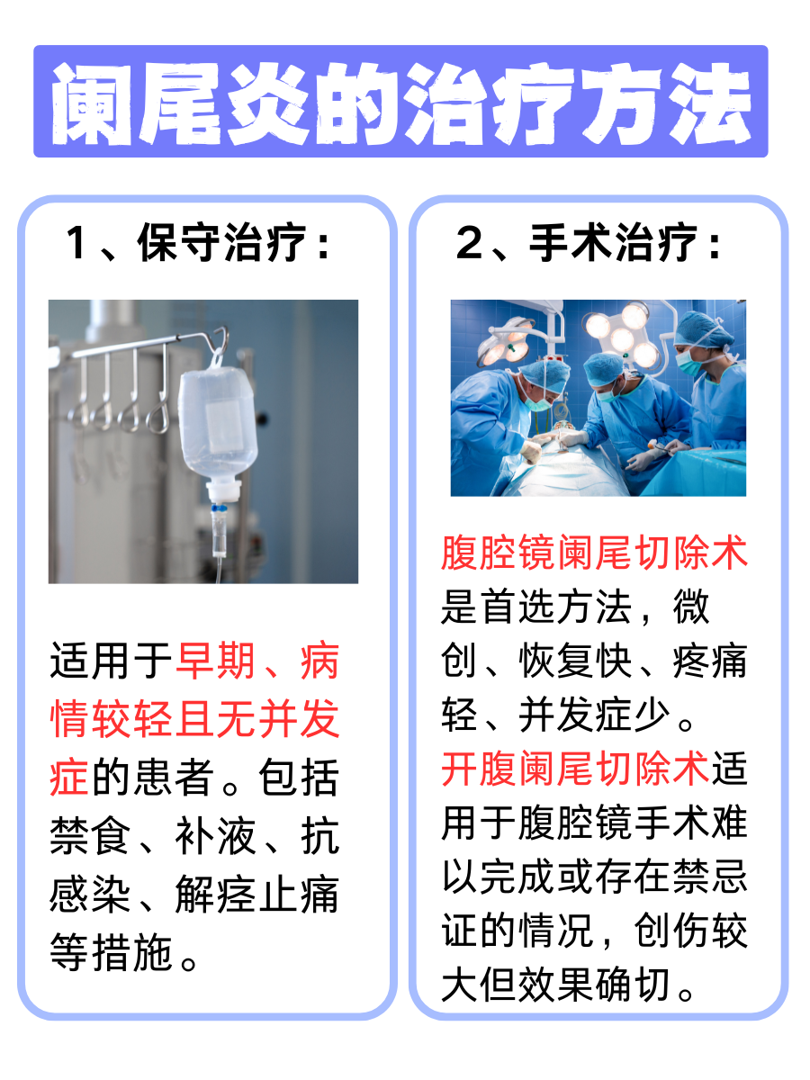 阑尾炎来袭不用怕，自检方法在手，健康我有！