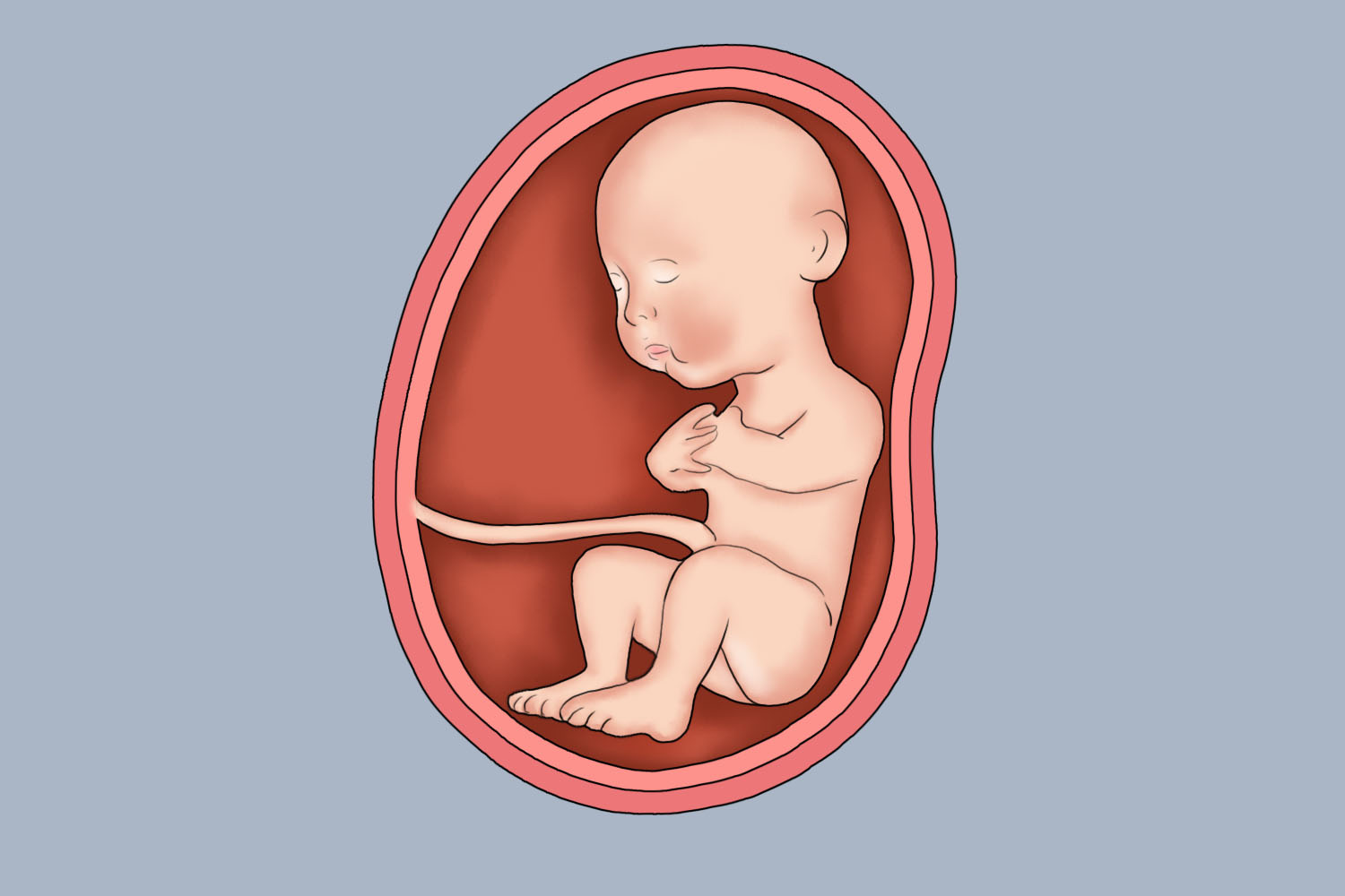 妊娠28周前臀位图