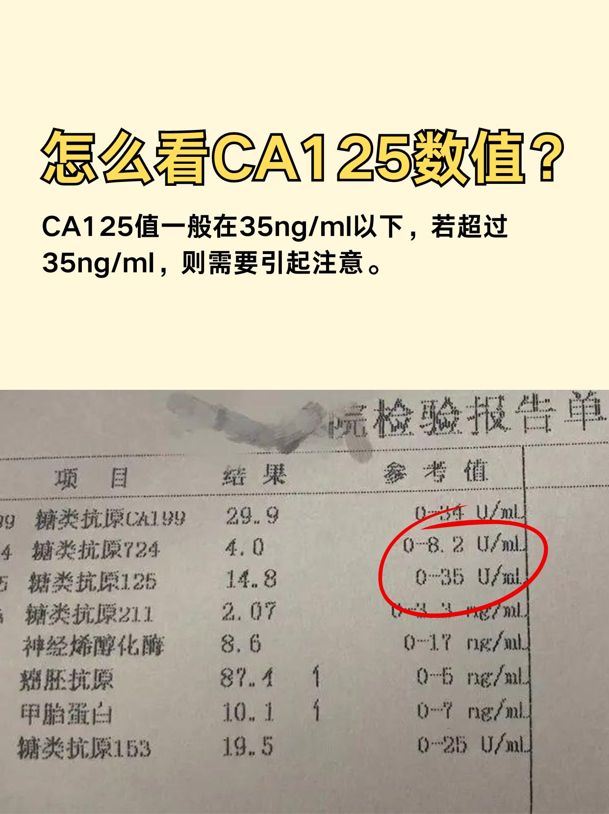 CA125是什么肿瘤指标，一文告诉你！