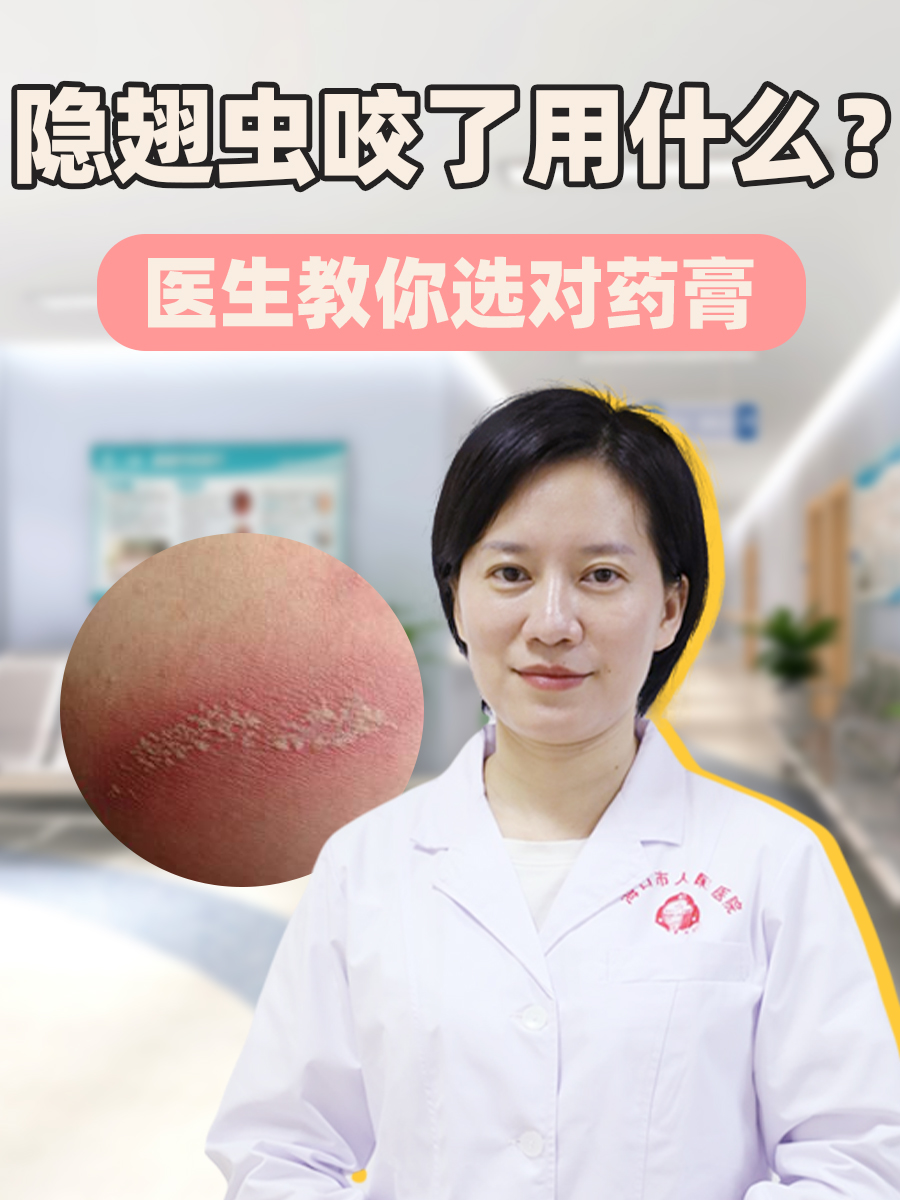 隐翅虫咬了用什么?医生教你选对药膏
