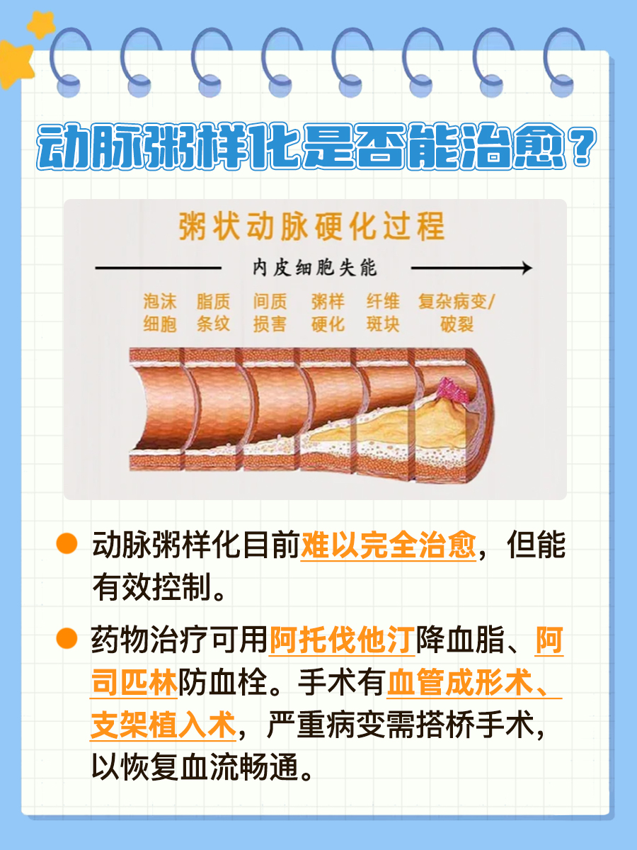 揭秘：动脉粥样化可以治愈吗
