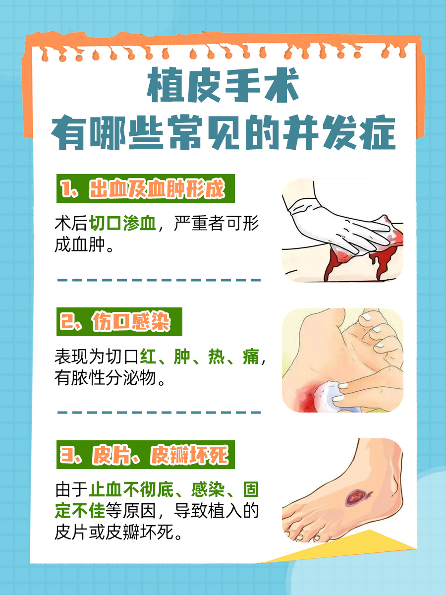 一文解析：做植皮手术大约需要多少钱