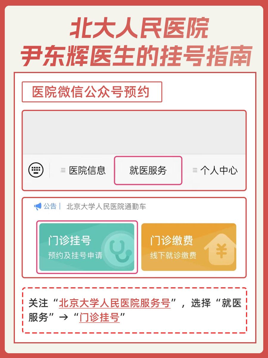 北大人民医院尹东辉医生怎么样?怎么挂号?