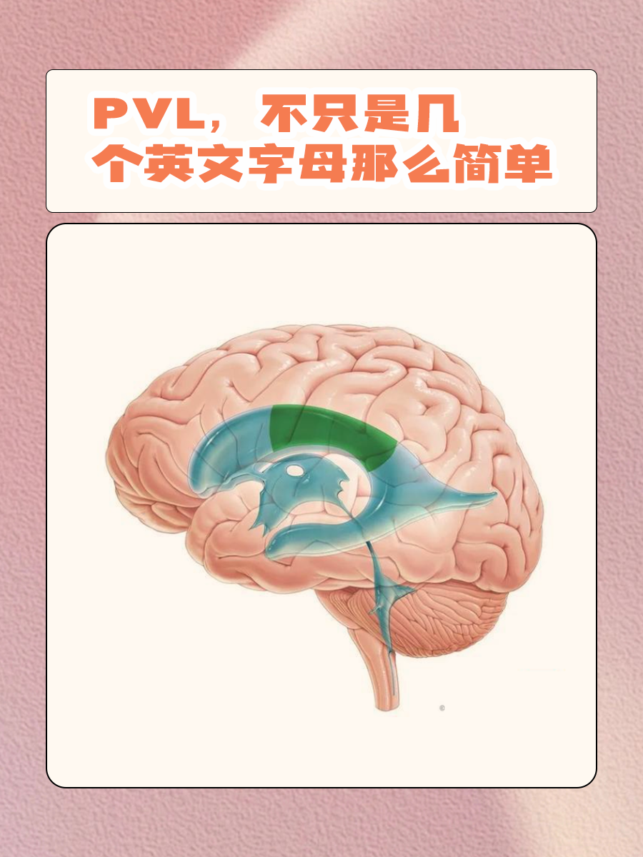 PVL，不只是几个英文字母那么简单