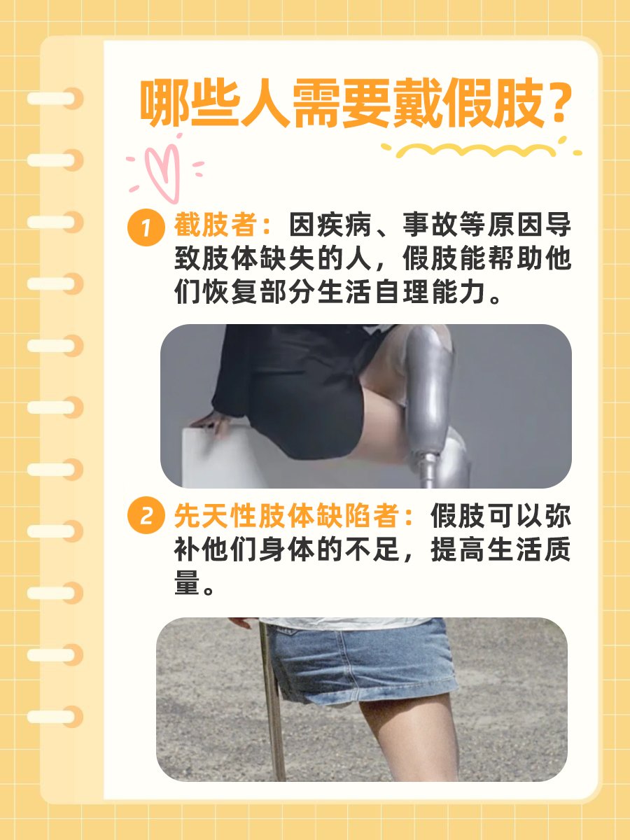 想要做手指假肢没有门路？问医生就可以少走弯路