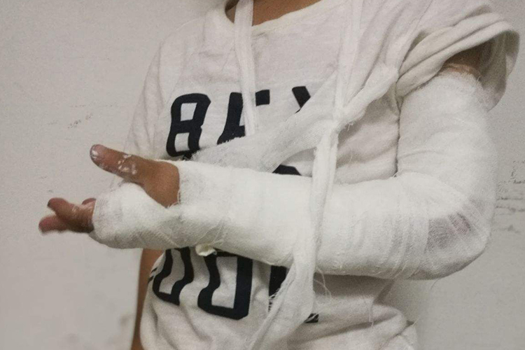 手腕石膏包扎功能位图