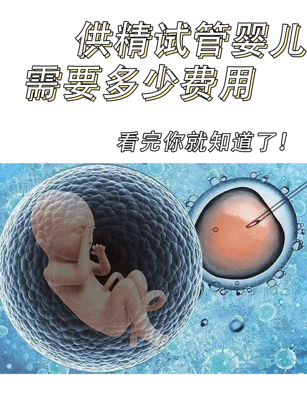 供精试管婴儿需要多少费用，看完你就知道了！