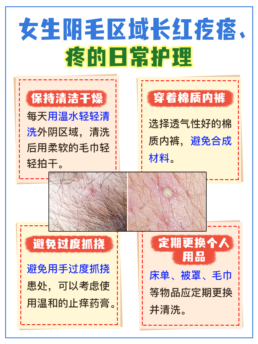 女生私密尴尬：毛毛区红疙瘩痛，原因在这里！