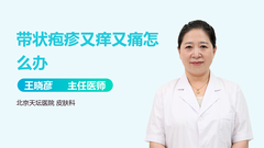 带状疱疹又痒又痛怎么办