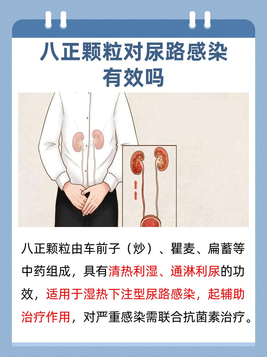 解析：八正颗粒对尿路感染有效吗